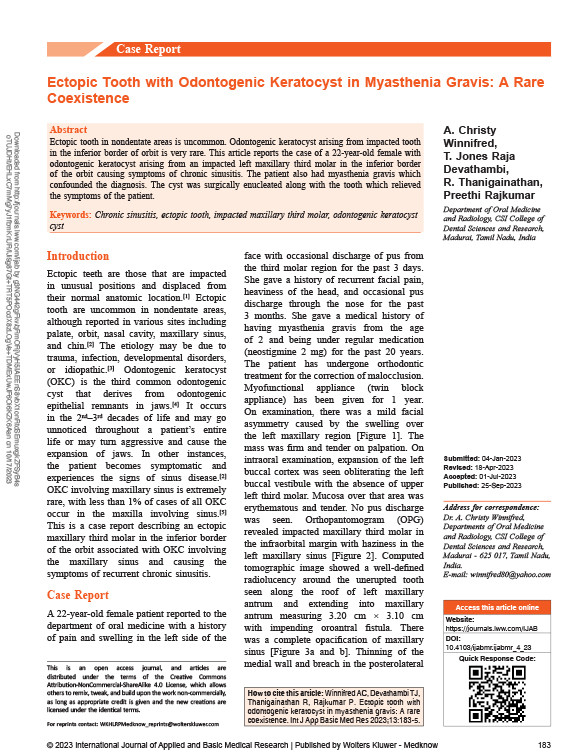 Ectopic tooth with odontogenic keratocyst in myasthenia gravis: a rare